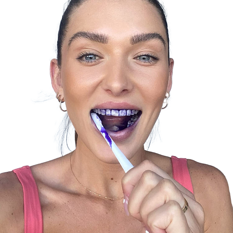 SmileKit V34: De Ultieme Oplossing voor Wittere en Gezondere Tanden